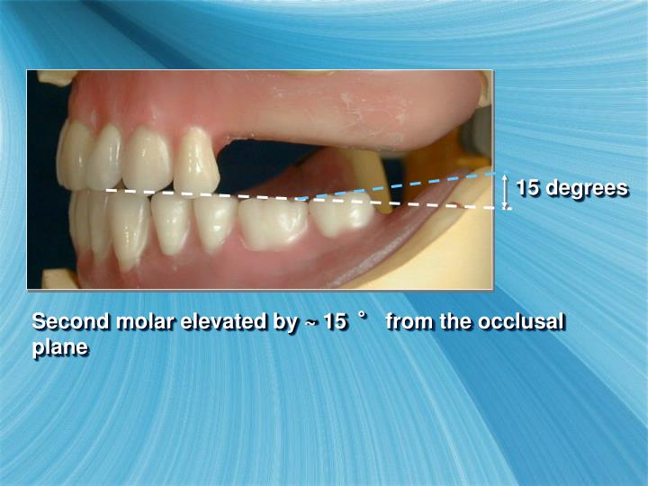 PPT Setting Posterior Teeth PowerPoint Presentation ID4484665