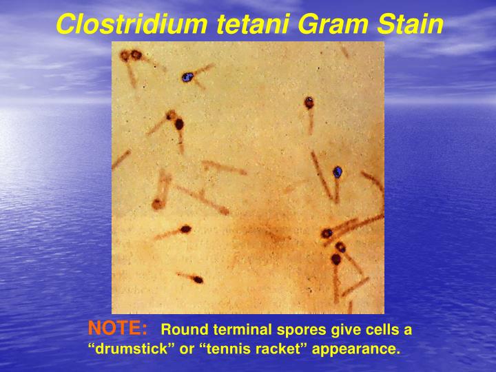 PPT Tetanus PowerPoint Presentation ID4505594