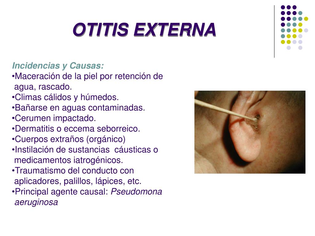 PPT OTITIS PowerPoint Presentation, free download ID4511398