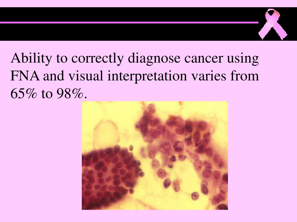 PPT Prognostic Prediction of Breast Cancer Using C5 PowerPoint Presentation ID4515471