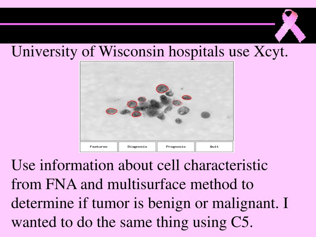 PPT Prognostic Prediction of Breast Cancer Using C5 PowerPoint Presentation ID4515471