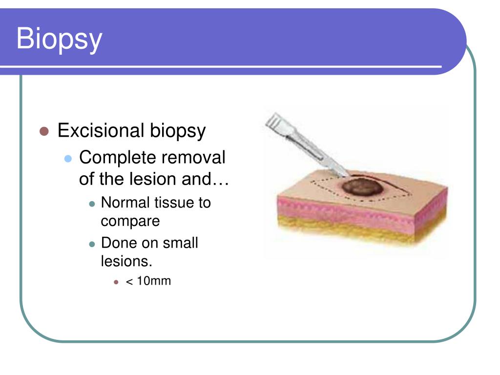 PPT Chapter 25 Oral and Maxillofacial Surgery PowerPoint Presentation