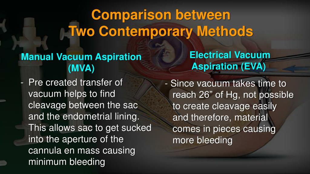 PPT MVA PowerPoint Presentation, free download ID4524422