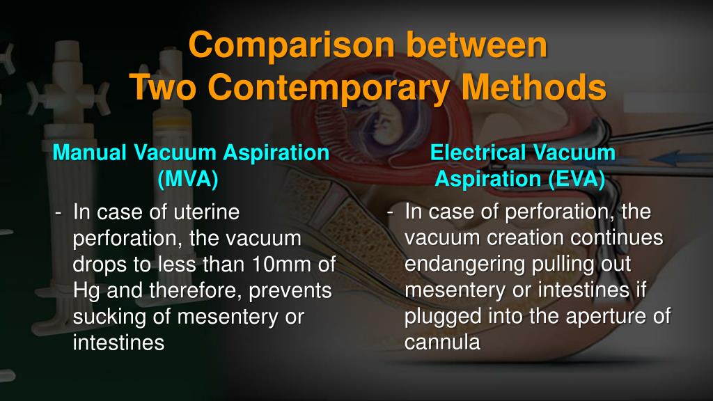 PPT MVA PowerPoint Presentation, free download ID4524422