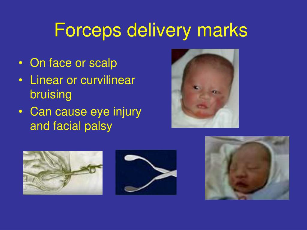 PPT Common Rashes in the Newborn PowerPoint Presentation, free
