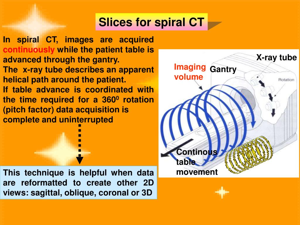 PPT Introduction to Computerized Tomography Dr / Ibrahim Alshikh
