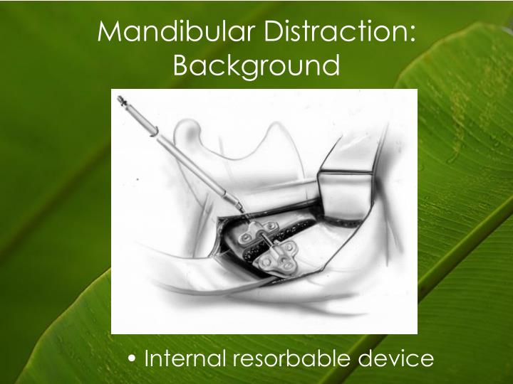 PPT Early Mandibular Distraction Osteogenesis in Pierre Robin