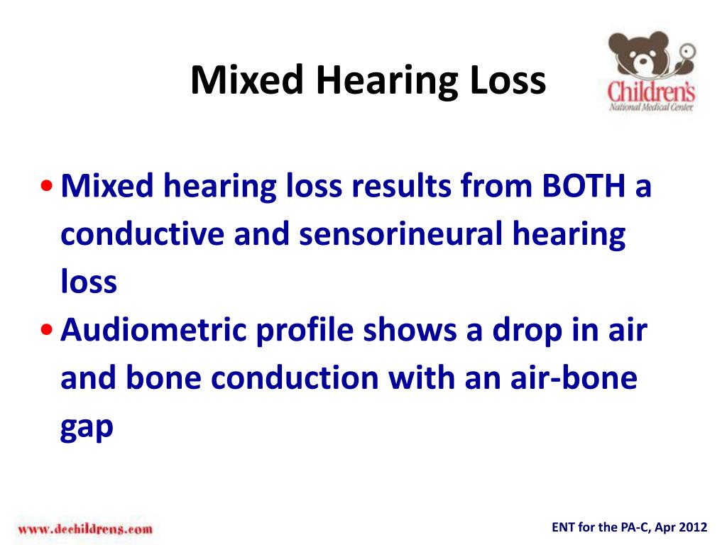 PPT Pediatric Hearing Loss and Testing Techniques PowerPoint