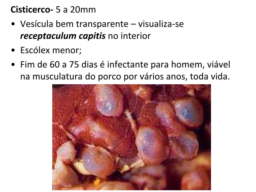PPT Classe Cestoda Taenia solium e Taenia saginata PowerPoint