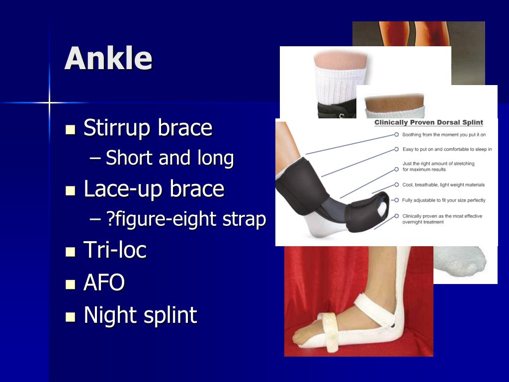 PPT Common Orthotics PowerPoint Presentation, free download ID4584763