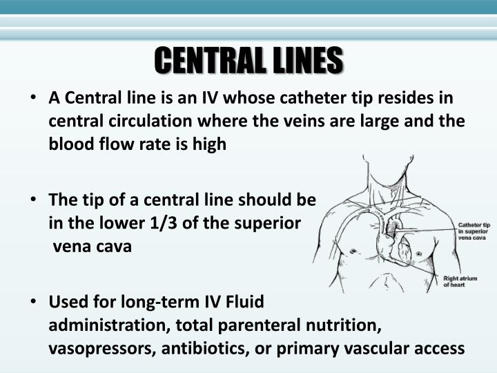 PPT Central Lines Patient Safety Considerations PowerPoint