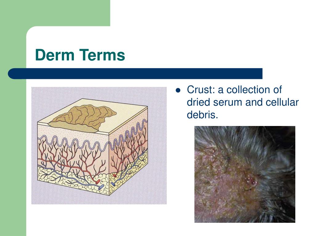 PPT Approach to Dermatology in the Emergency Department PowerPoint