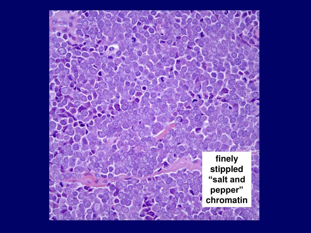 PPT Case 13 Dermatopathology PowerPoint Presentation, free download
