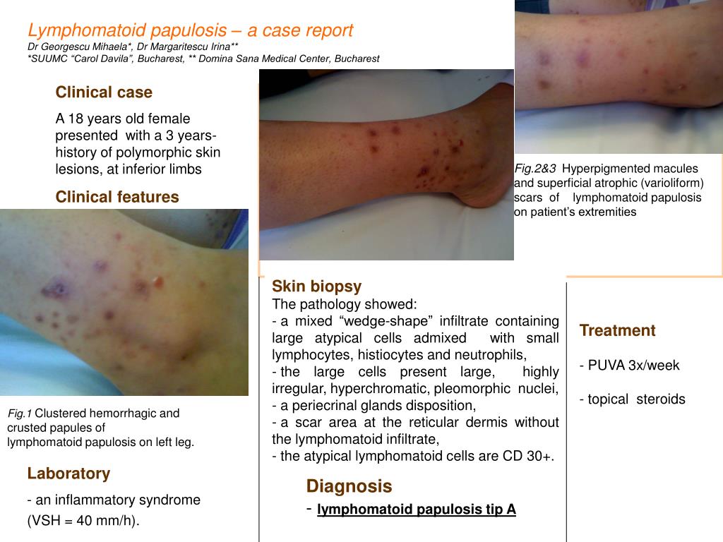 PPT Clinical case PowerPoint Presentation, free download ID4608590