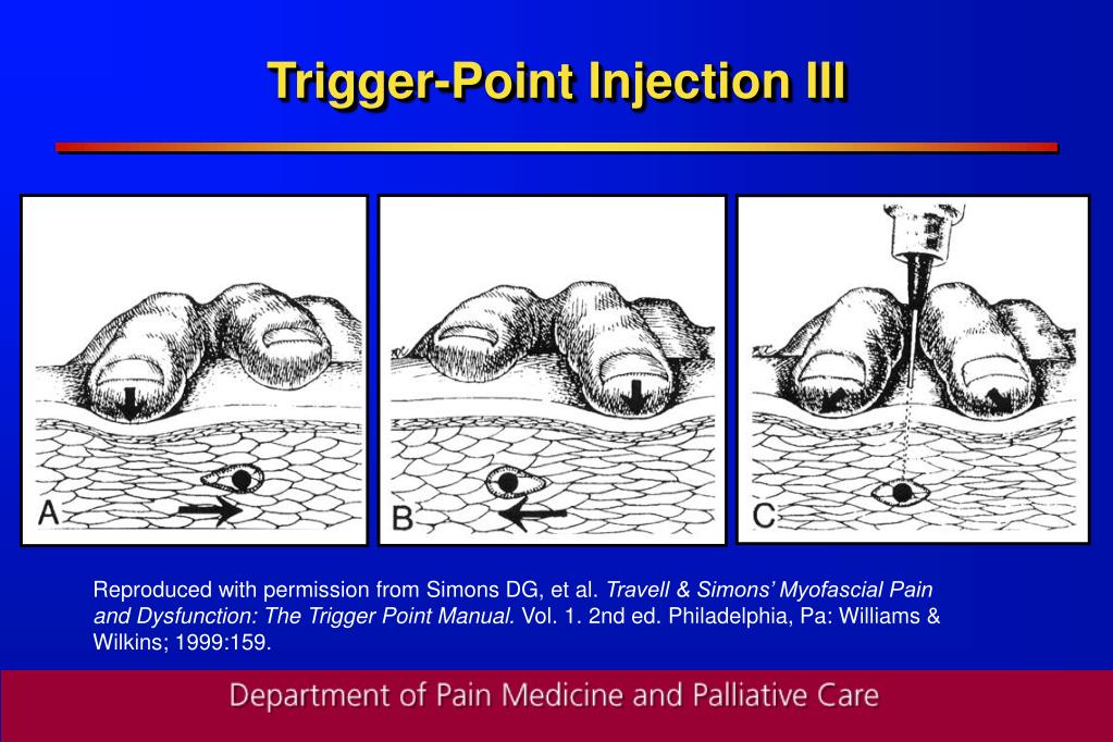 PPT Interventional Approaches to Chronic Pain Blocks, Stimulators