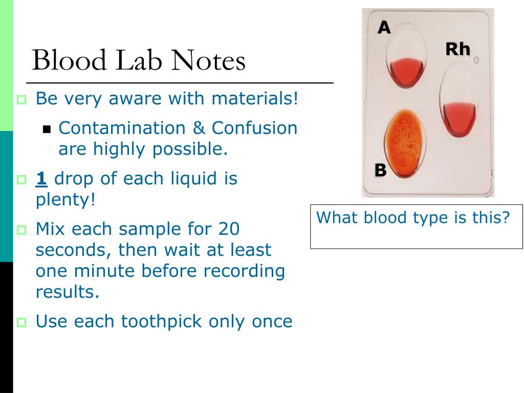 PPT Blood Types PowerPoint Presentation, free download ID4666555