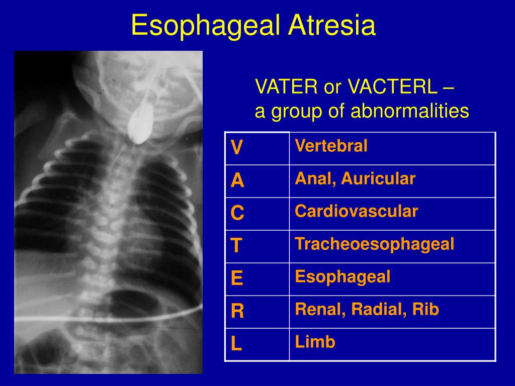 PPT DIAGNOSTIC IMAGING OF GASTROINTESTINAL TRACT IN CHILDREN