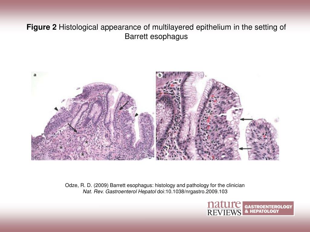 PPT Figure 2 Histological appearance of multilayered epithelium in