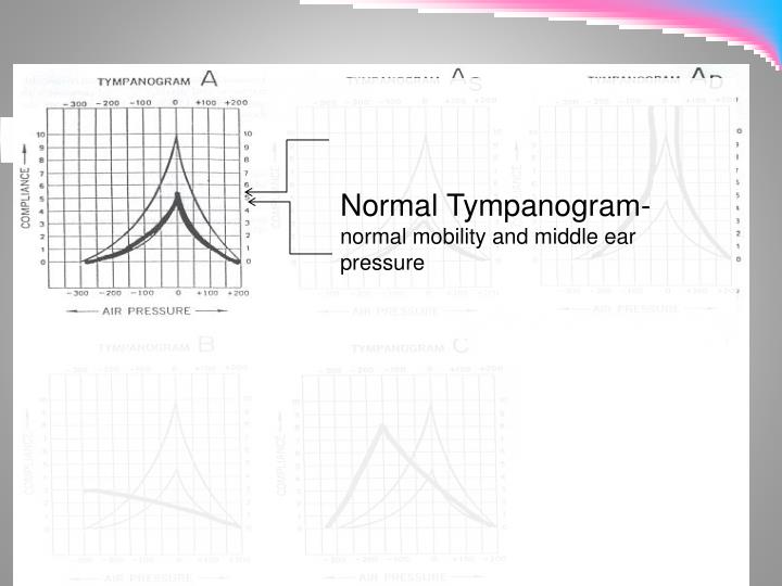 PPT Hearing Loss PowerPoint Presentation ID4675985