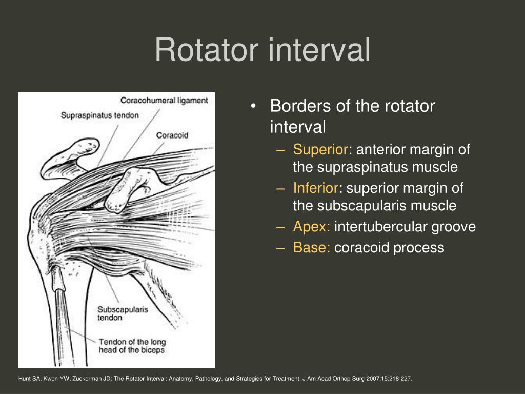 PPT Anatomy and Pathology of the Rotator Interval PowerPoint