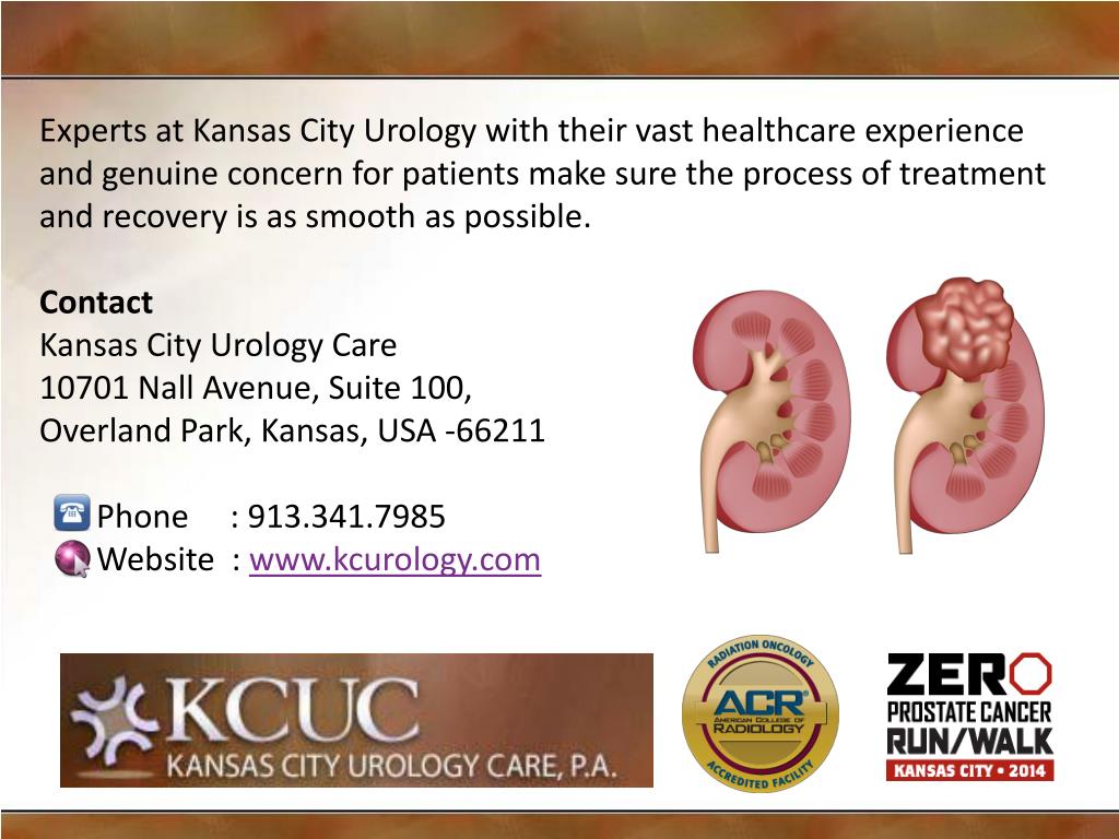 PPT Cutting edge technology helping prostate cancer treatment