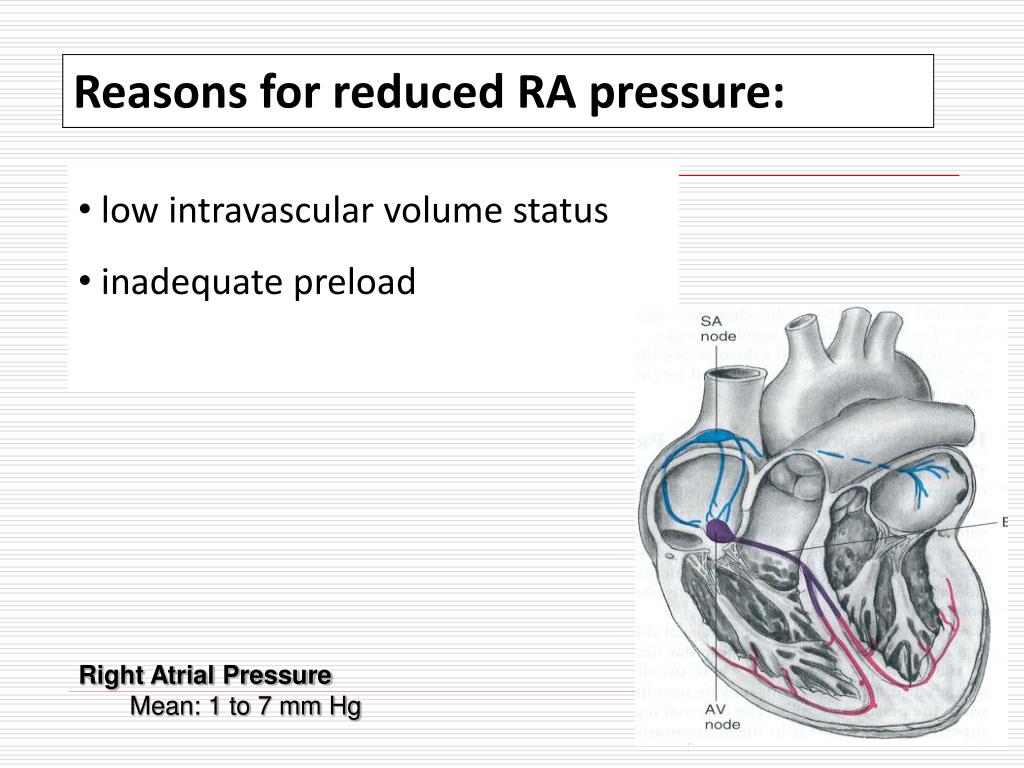 PPT Hemodynamic Monitoring and Transthoracic Lines PowerPoint
