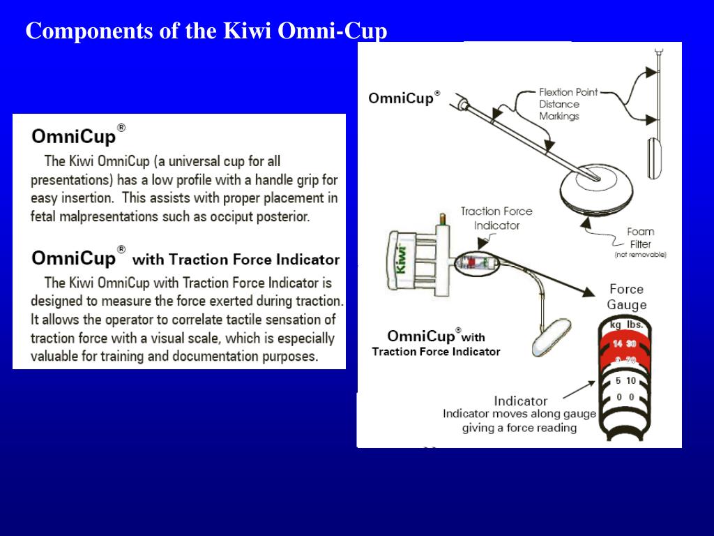 Vacuum Delivery Pelvic Floor at Stephanie Wilson blog