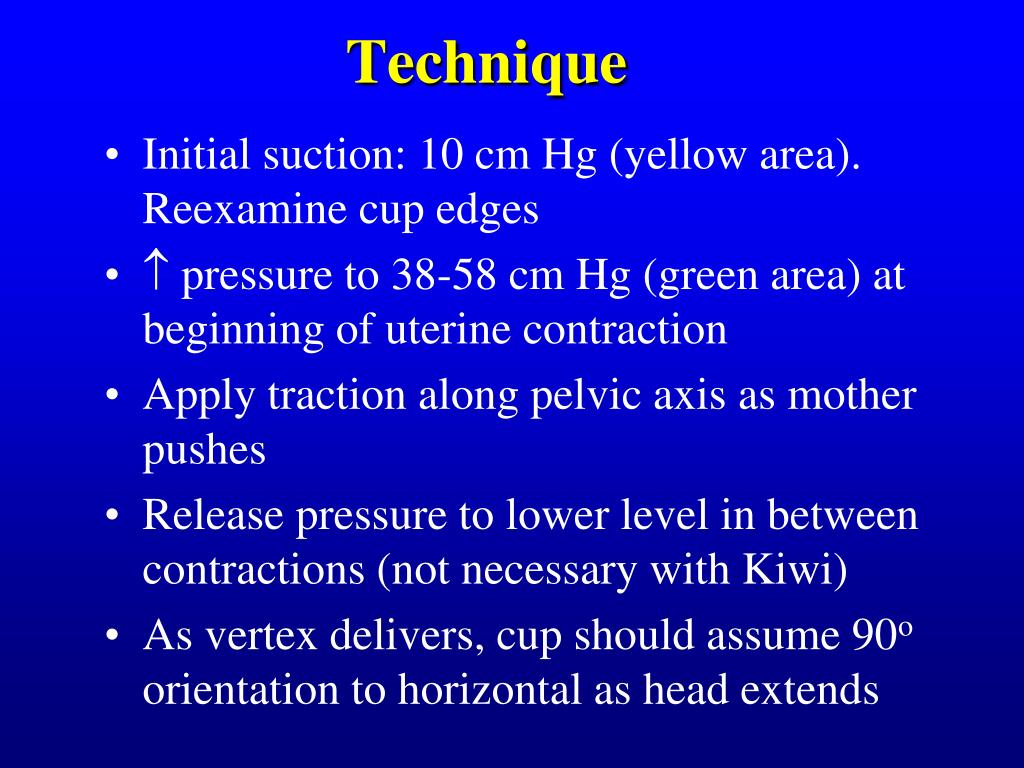 PPT Vacuum Assisted Vaginal Delivery PowerPoint Presentation, free