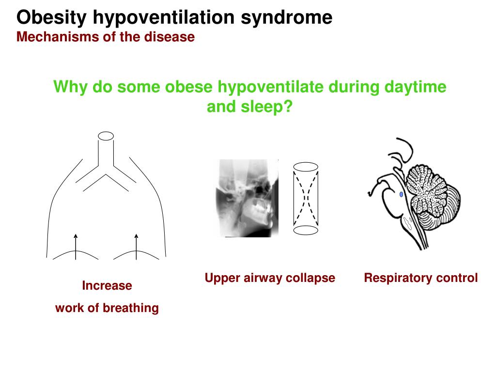 PPT Sleeprelated hypoventilation syndromes PowerPoint Presentation