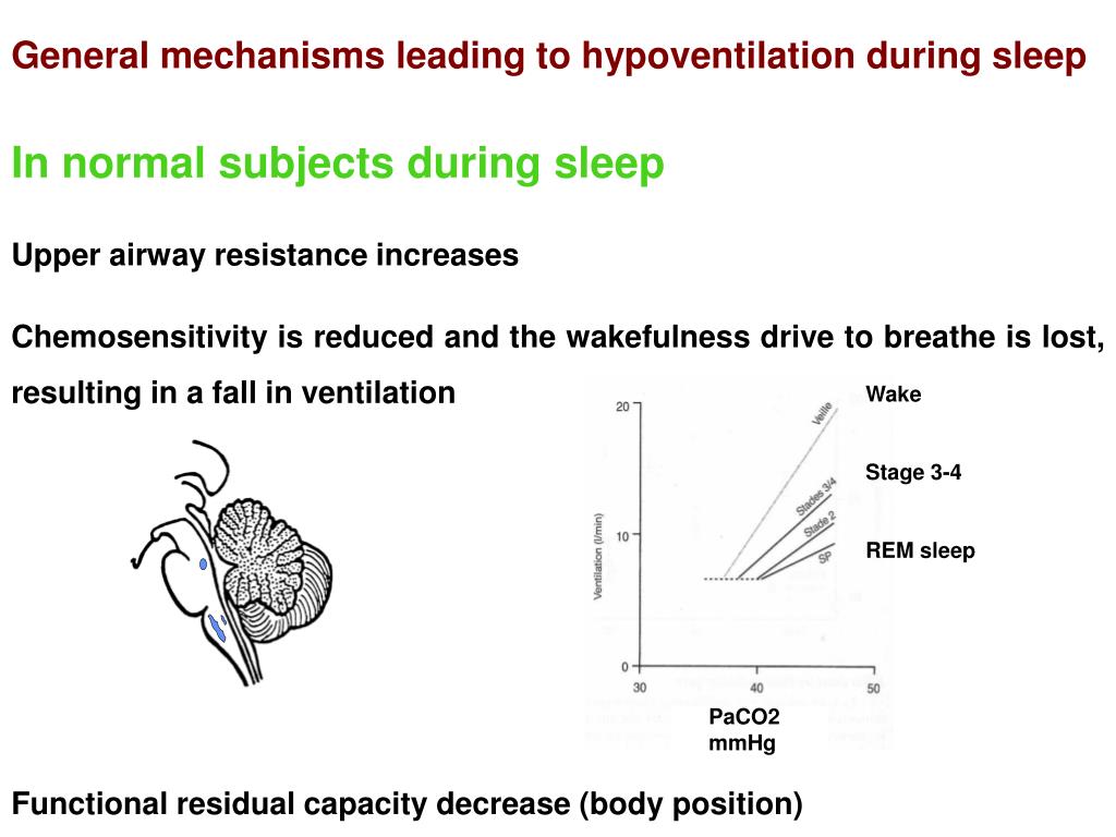 PPT Sleeprelated hypoventilation syndromes PowerPoint Presentation
