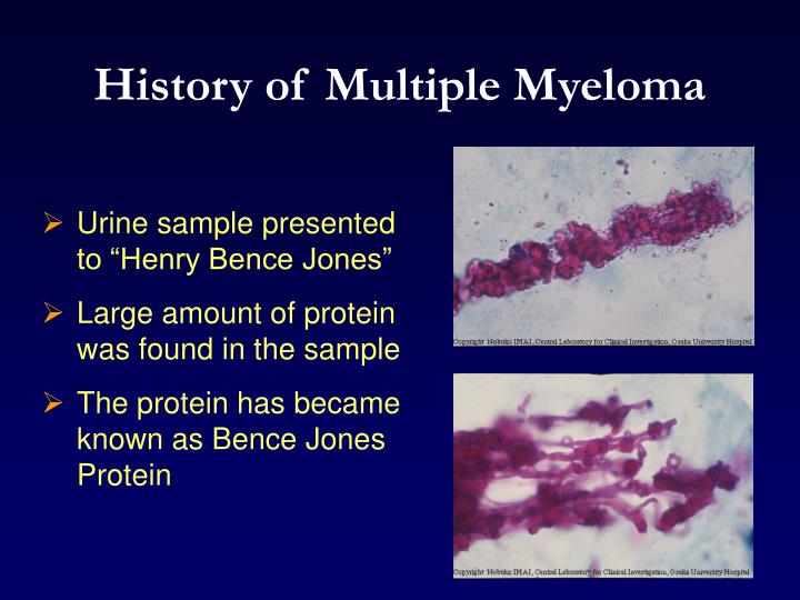 PPT Advances in Biology and Pathophysiology of Multiple Myeloma