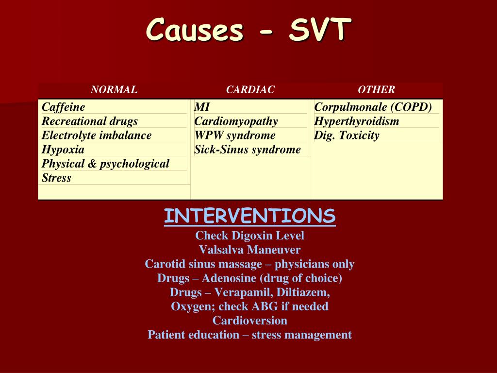 PPT Basic ECG PowerPoint Presentation, free download ID4748985
