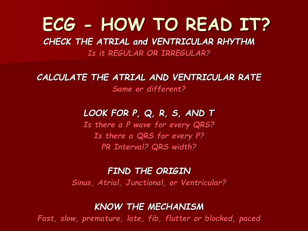 PPT Basic ECG PowerPoint Presentation, free download ID4748985