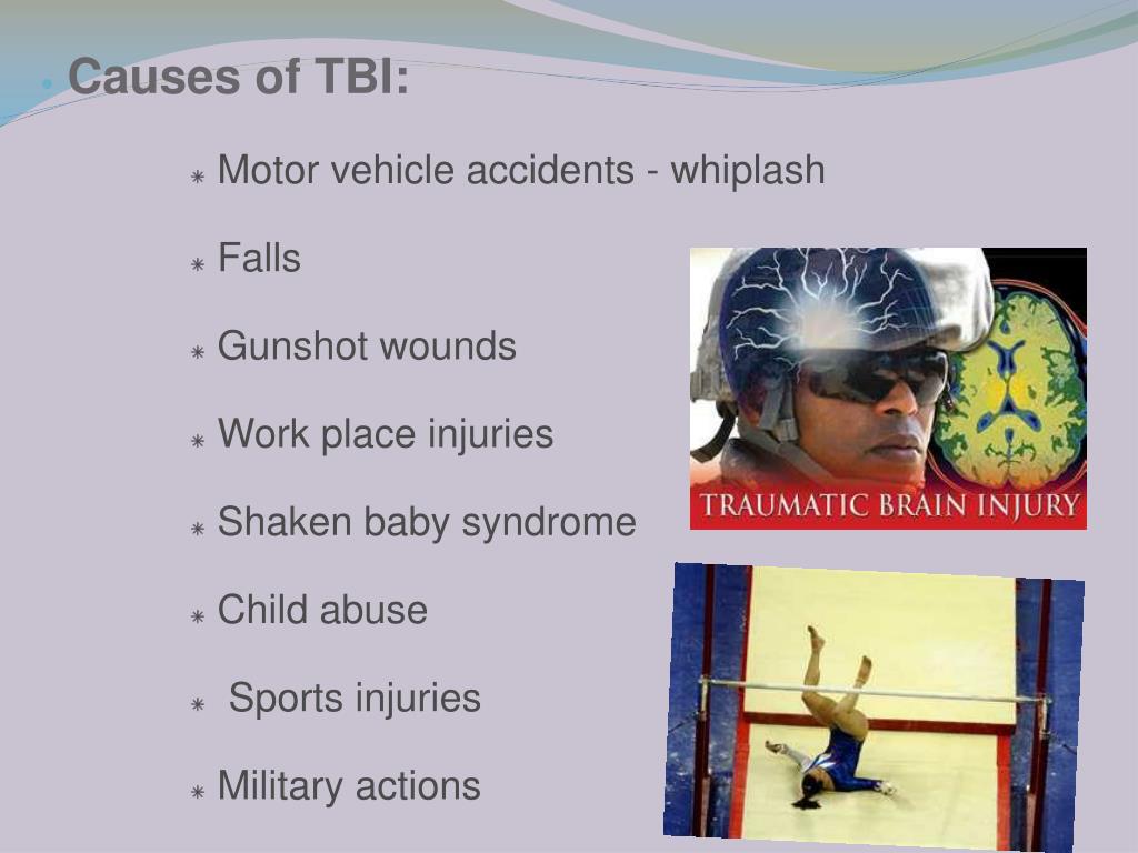 PPT Vision Deficits After TBI PowerPoint Presentation, free download