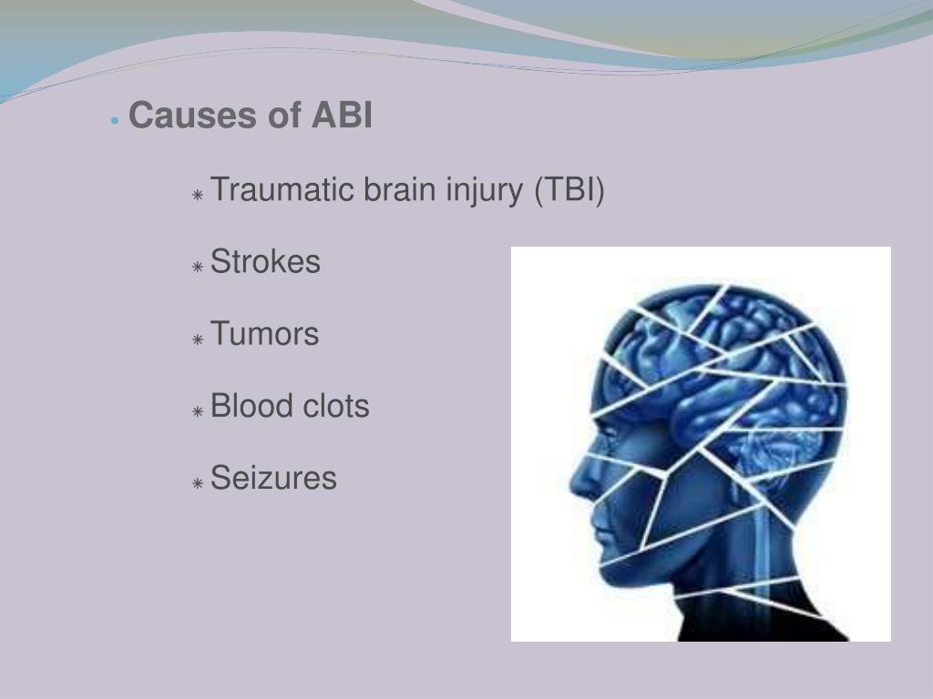 PPT Vision Deficits After TBI PowerPoint Presentation, free download