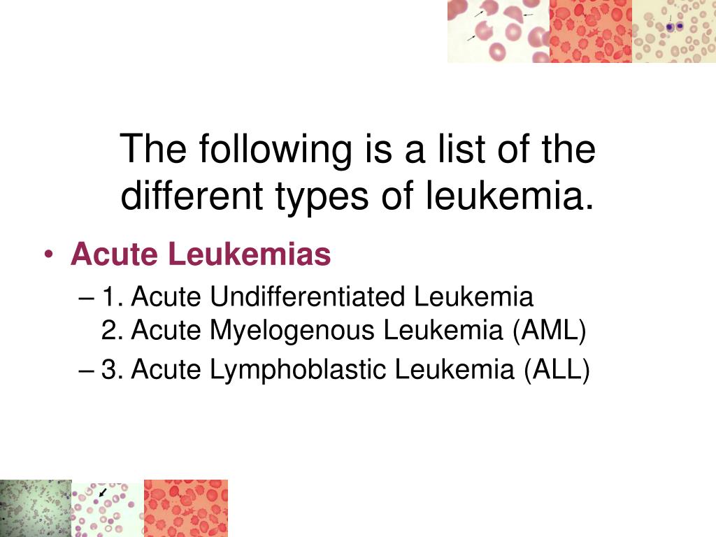 PPT What is Leukemia? PART 1 PowerPoint Presentation, free download