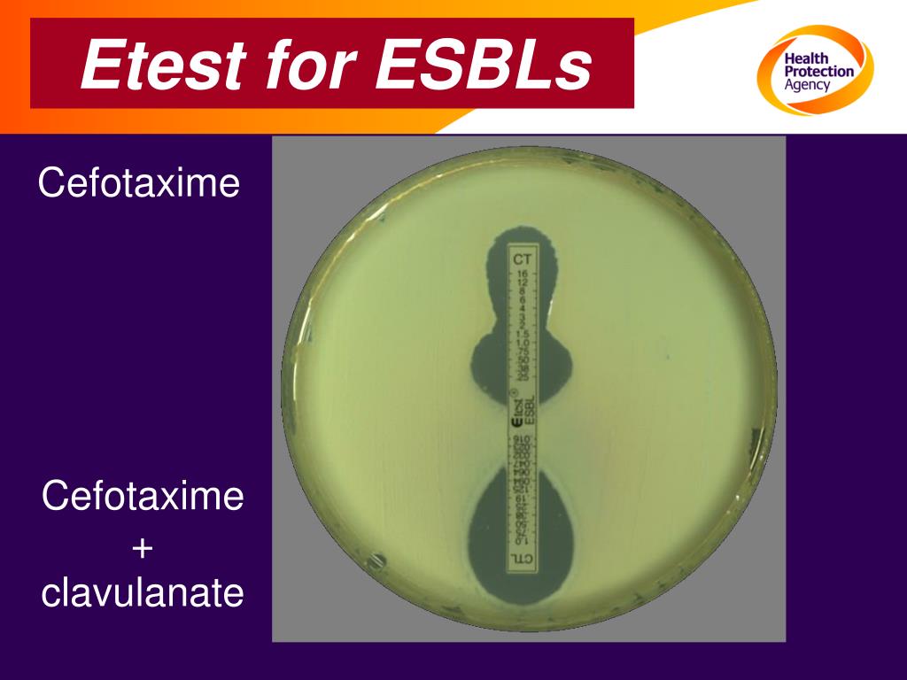 PPT Detection of b lactamase mediated resistance PowerPoint