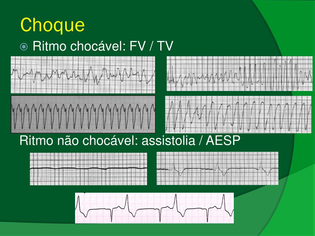 PPT I CURSO DE CONDUTAS MÉDICAS NAS INTERCORRÊNCIAS EM PACIENTES