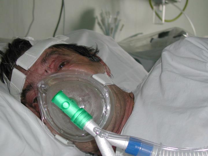 PPT Ossigenoterapia e Ventilazione meccanica non invasiva PowerPoint