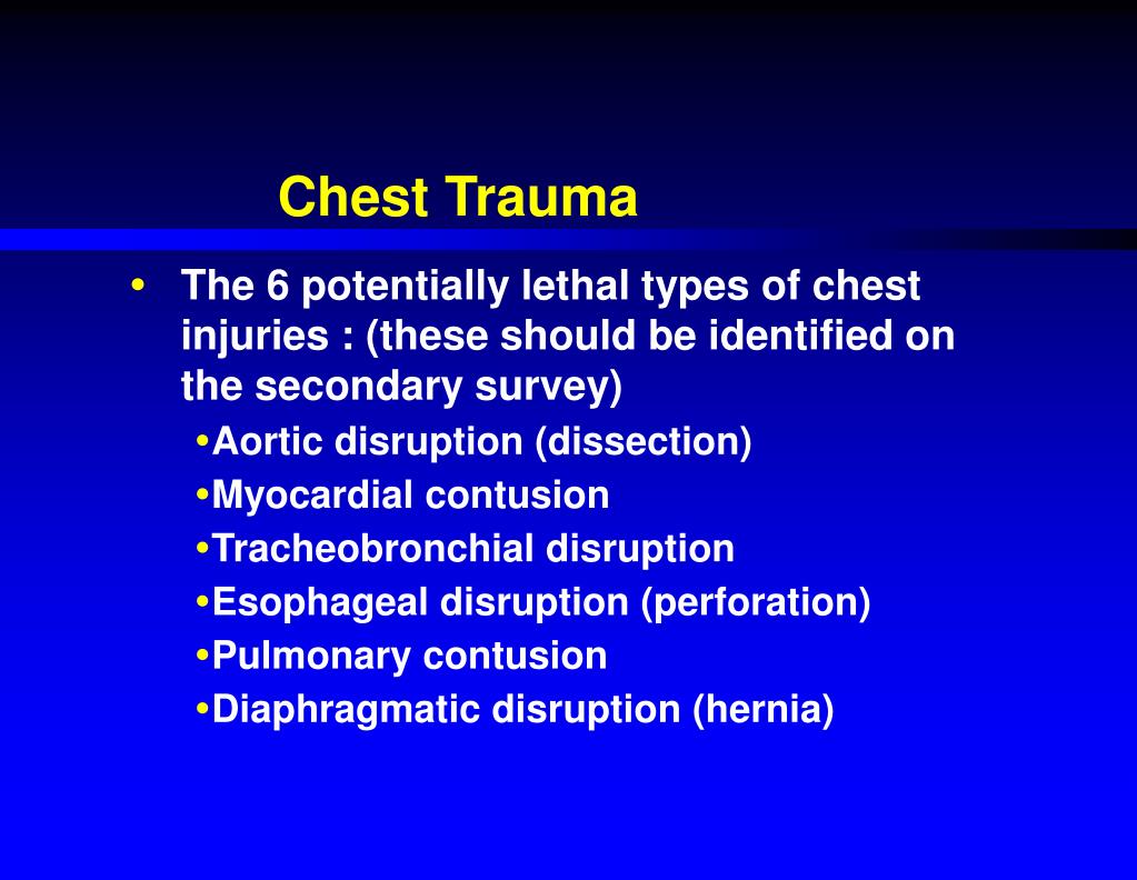 PPT Chest Trauma PowerPoint Presentation, free download ID4780705