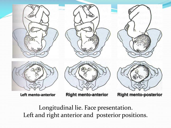 PPT Lecture 5 PHASES OF PARTURITION STAGES OF LABOR MECHANISM OF