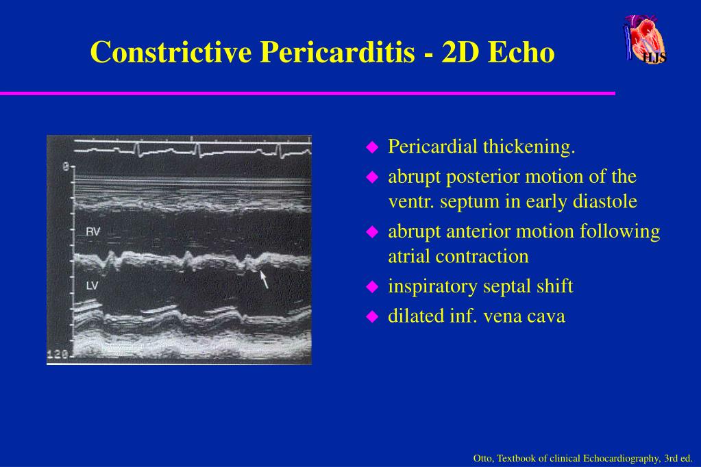 PPT HJS PowerPoint Presentation, free download ID4799394