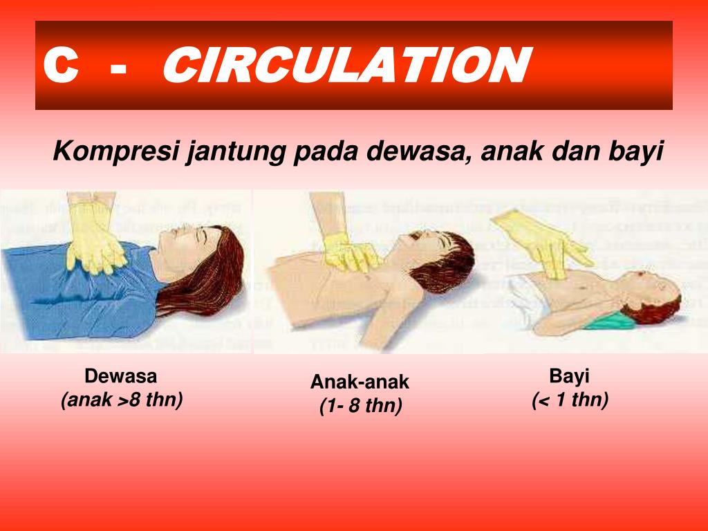 PPT RESUSITASI JANTUNG PARU (RJP) PowerPoint Presentation, free