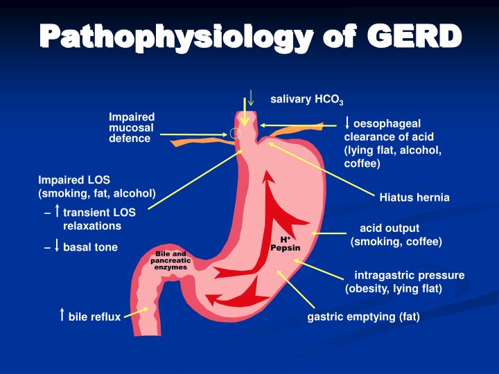 PPT Gastroesophageal Reflux Disease (GERD) PowerPoint Presentation
