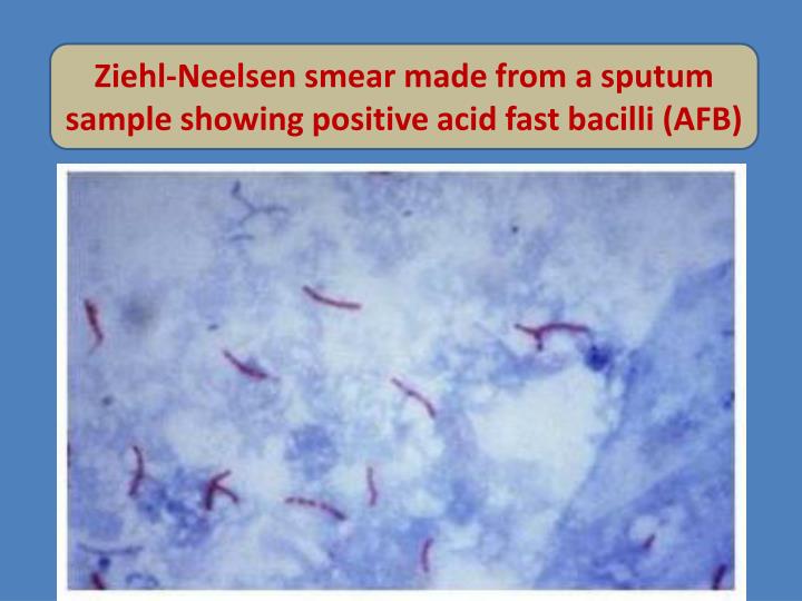 PPT Mycobacterium tuberculosis & pulmonary tuberculosis