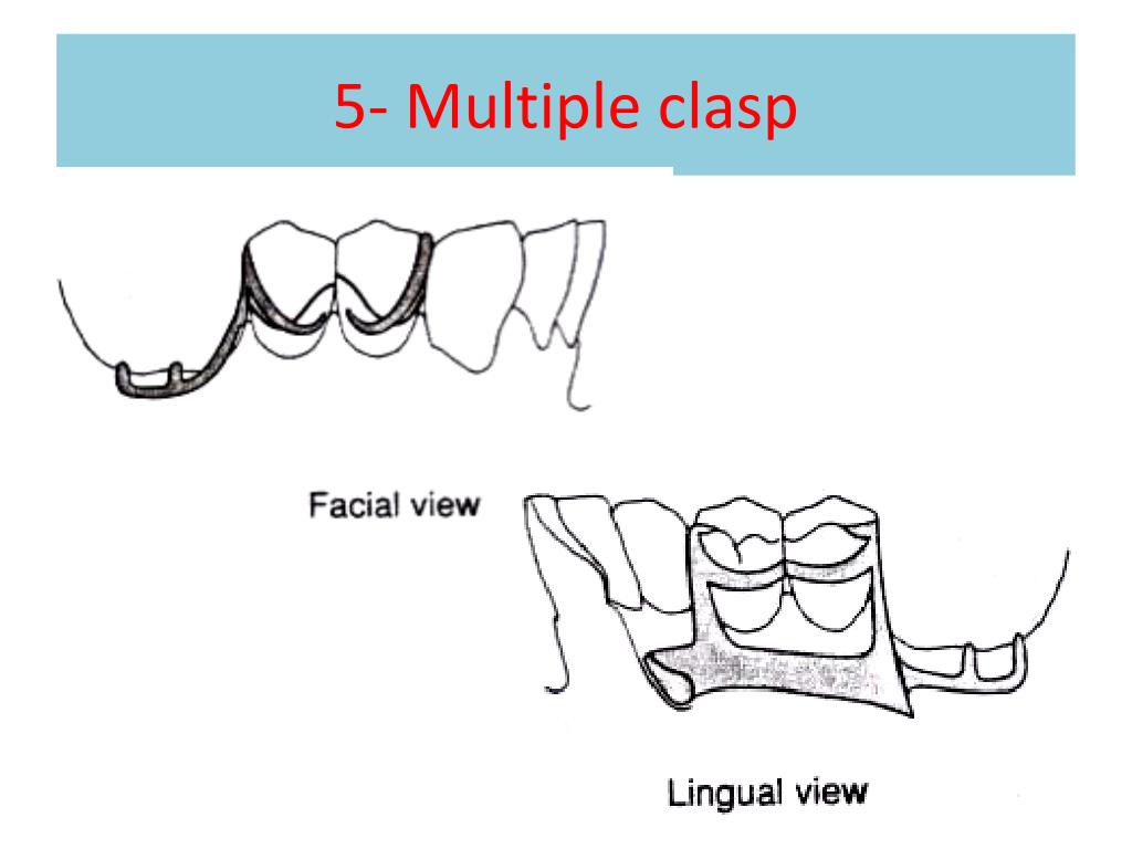 PPT DIRECT RETENTION. PowerPoint Presentation, free download ID4806159