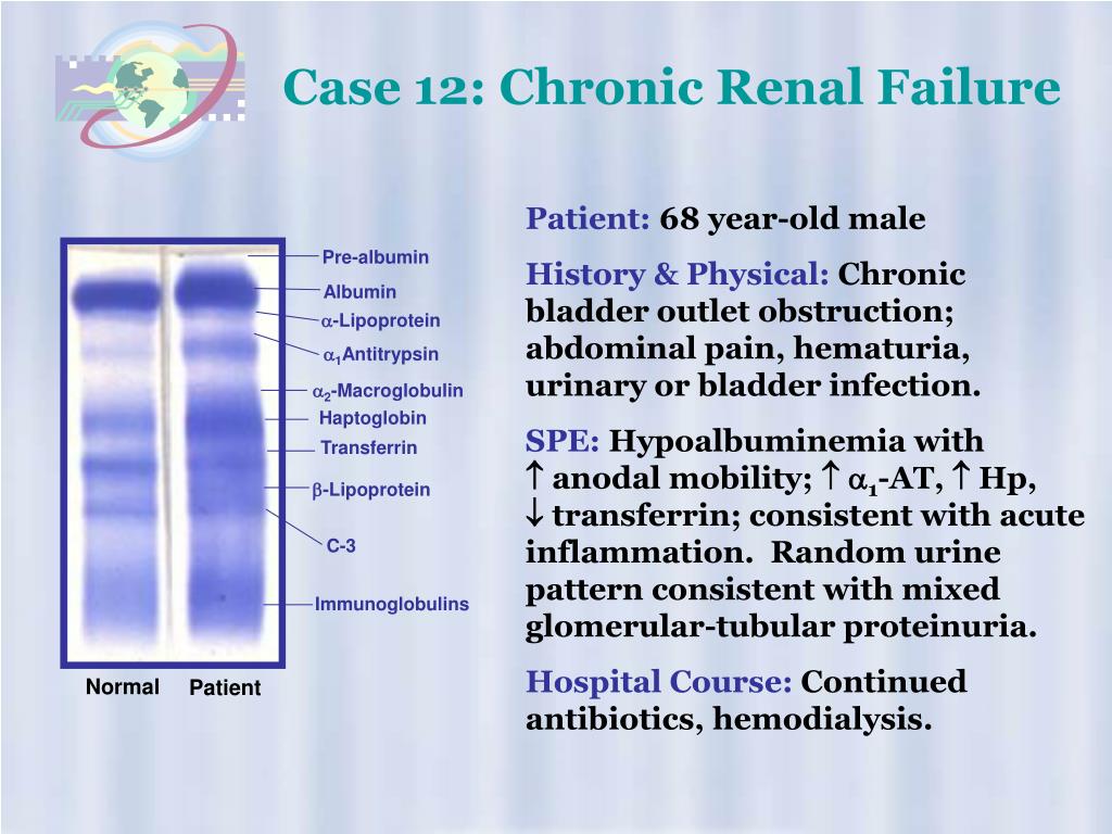PPT High Resolution Protein Electrophoresis PowerPoint Presentation