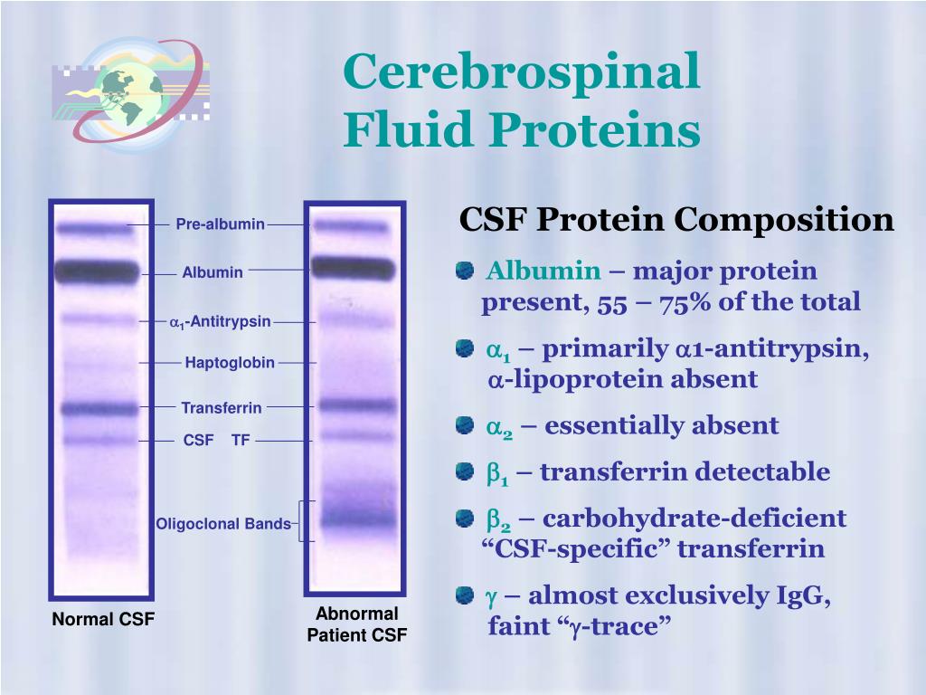 PPT High Resolution Protein Electrophoresis PowerPoint Presentation
