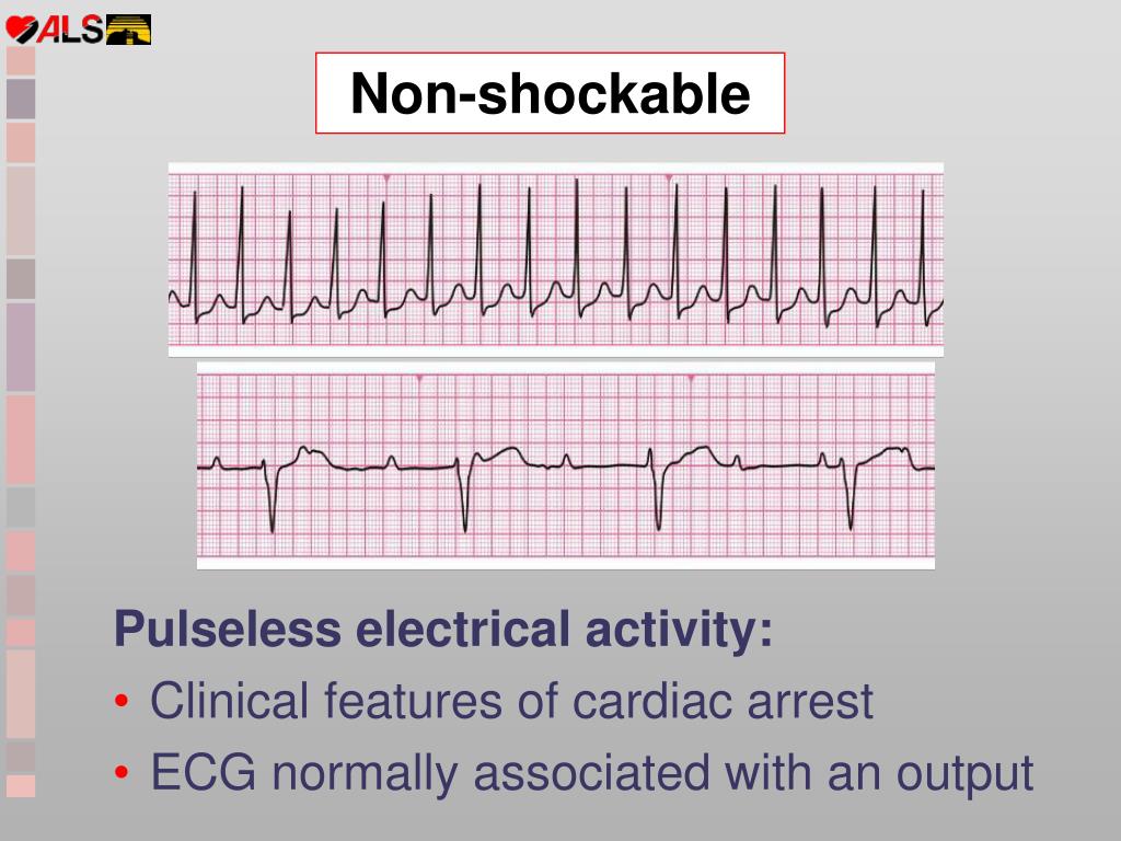 PPT ALS PowerPoint Presentation, free download ID4835625