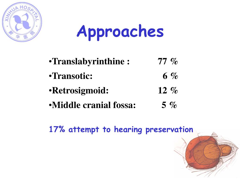 PPT Acoustic neuroma surgery —Shanghai experience PowerPoint
